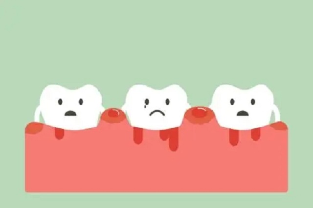 刷牙经常出血的原因介绍(图1)