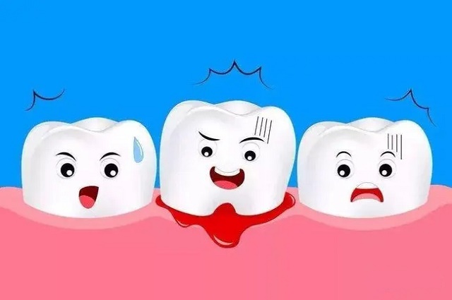 刷牙时牙龈老是出血的原因介绍(图1)