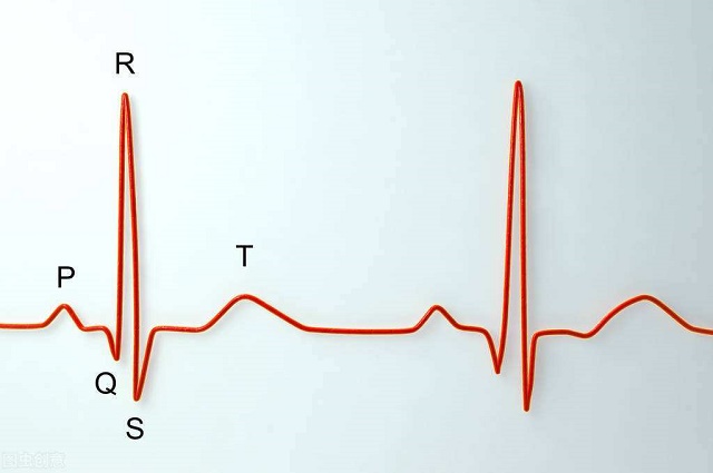 心电图t波改变是什么意思(图1)