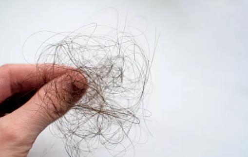 什么是季节性脱发(图2)