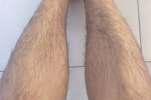 腿毛旺盛是什么原因
