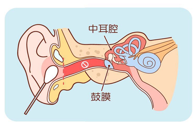 中耳炎是什么原因引起的
